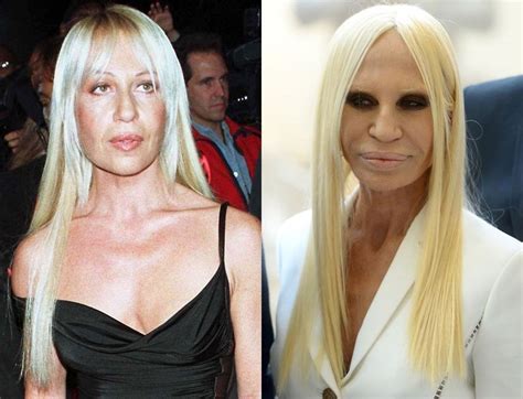 donatella versace then and now|Donatella Versace before and after.